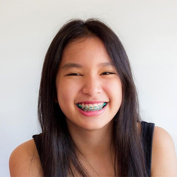 Smiling Child with Braces
